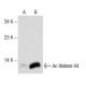 Western blot analysis of Ac-Histone H4 acetylation in untreated (A) and Scriptaid (sc-202807) treated (B) A549 whole cell
