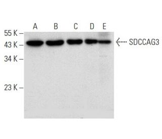 SDCCAG3 Antibody (E-2) - Western Blotting - Image 309522 