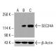 SEC24A 抗體 (4D9):sc-517155。未經化學處理之 HCT-116 (A)、經化學處理之 HCT-116 (B) 及 HeLa (C) 完整細胞裂解液中 SEC24A 之 Western blot 分析。β-肌動蛋白(C4):sc-47778 用作上樣對照。檢測試劑:m-IgG Fc BP-HRP:sc-525409。 SEC24A Antibody (4D9) - Western Blotting - Image 416129