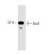 Sec8 Antibody (14) - Western Blotting - Image 127508
