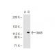 Sec8 Antibody (LB-2) - Western Blotting - Image 44447 