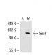 Sec8 Antibody (LB-2) - Western Blotting - Image 53116