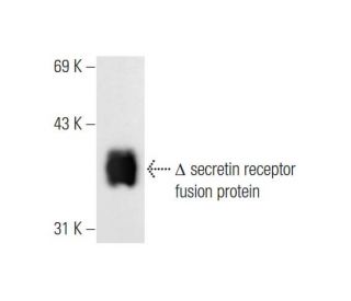 secretin receptor Antibody (E-9) - Western Blotting - Image 66251