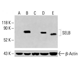 SELB Antibody (F-4) - Western Blotting - Image 414388Each CRISPR/Cas9 Knockout (KO) Plasmid product consists of a pool of 3 plasmids designed to ensure identification and cleavage of a specific gene for maximum knockout efficiency. Each plasmid encodes a unique 20 nt sequence derived from the GeCKO (v2) library. 