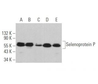 Selenoprotein P Antibody (B-9) - Western Blotting - Image 363411Each CRISPR/Cas9 Knockout (KO) Plasmid product consists of a pool of 3 plasmids designed to ensure identification and cleavage of a specific gene for maximum knockout efficiency. Each plasmid encodes a unique 20 nt sequence derived from the GeCKO (v2) library.