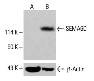 SEMA6D Antibody (A-8) - Western Blotting - Image 415220 