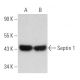 Septin 1 Antibody (B-8) - Western Blotting - Image 366208 