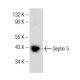 Septin 5 Antibody (E-10) - Western Blotting - Image 147141 
