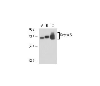 Septin 5 Antibody (SP19) - Western Blotting - Image 17192 