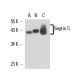 Septin 5 Antibody (SP19) - Western Blotting - Image 17192 