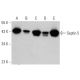 Septin 5 Antibody (SP19) - Western Blotting - Image 359537 