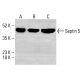 Septin 5 Antibody (SP19) - Western Blotting - Image 413227