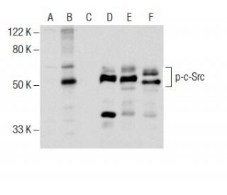 Western blot analysis of c-Src phosphorylation in untreated (A,D), Ser/Thr induction cocktail (sc-362324) treated (B,E) an 