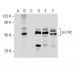 Western blot analysis of c-Src phosphorylation in untreated (A,D), Ser/Thr induction cocktail (sc-362324) treated (B,E) an 