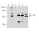 Western blot analysis of c-Src phosphorylation in untreated (A,D), Ser/Thr induction cocktail (sc-362324) treated (B,E) an 