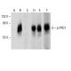 Western blot analysis of PRC1 phosphorylation in untreated (A,D), Ser/Thr induction cocktail (sc-362324) treated (B,E) and