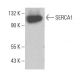 SERCA1 Antibody (4i390) - Western Blotting - Image 380416