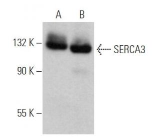 SERCA3 Antibody (PL/IM430) - Western Blotting - Image 362854 