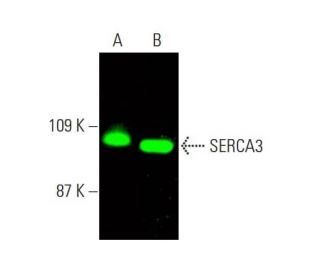 SERCA3 Antibody (PL/IM430) - Western Blotting - Image 386672 