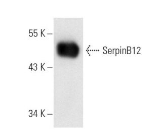 SerpinB12 Antibody (H3-1B) - Western Blotting - Image 9885 