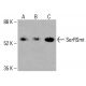 SerRSmt 抗体(C-11):sc-514991。Western blot分析HeLa(A)、K-562(B)和HCT-116(C)完整细胞裂解液中SerRSmt的表达。使用的检测试剂:m-IgG2b BP-HRP:sc-542741。 SerRSmt Antibody (C-11) - Western Blotting - Image 415852