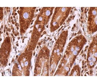 SESN2 Antibody (D-4) - Immunohistochemistry - Image 373663 