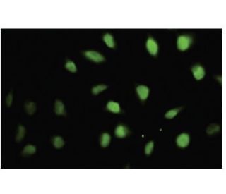 SETX Antibody (QQ-7) - Immunofluorescence - Image 35524