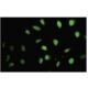 SETX Antibody (QQ-7) - Immunofluorescence - Image 35524
