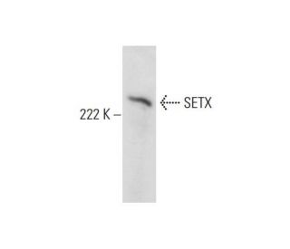 SETX Antibody (QQ-7) - Western Blotting - Image 294818 