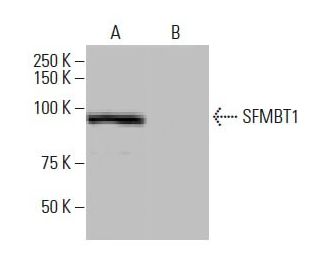 SFMBT1 Antibody (FT-34) - Western Blotting - Image 65050