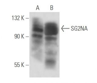 SG2NA Antibody (S68) - Western Blotting - Image 17583