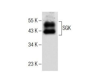 SGK Antibody (G-4) - Western Blotting - Image 283824 