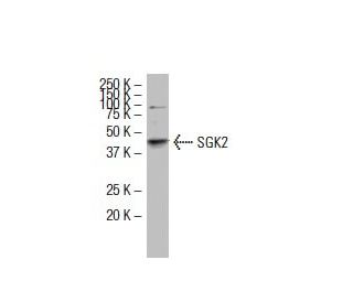 SGK2 Antibody (3Q-2) - Western Blotting - Image 33732 