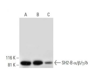 SH2-B &alpha;/&beta;/&gamma;/&delta; Antibody (46) - Western Blotting - Image 295735 