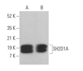 SH2D1A Antibody (1D12) - Western Blotting - Image 372919 