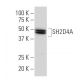 SH2D4A Antibody (63-J) - Western Blotting - Image 33662 
