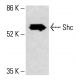 Shc-Antikörper (H-11): sc-398289. Western Blot Analyse der Shc Expression in HeLa-Gesamtzelllysaten. Verwendetes Nachweisreagenz: m-IgG Fc BP-HRP: sc-525409. Shc Antibody (H-11) - Western Blotting - Image 415398