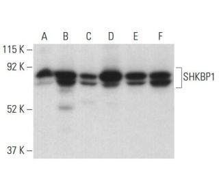 SHKBP1 Antibody (B-7) - Western Blotting - Image 398090 