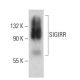 SIGIRR Antibody (D-2) - Western Blotting - Image 385186 