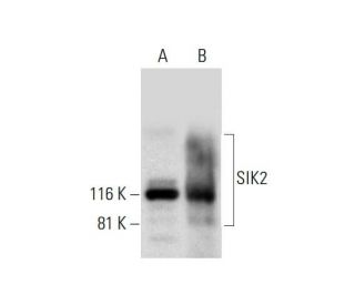 SIK2 Antibody (B-12) - Western Blotting - Image 294113 