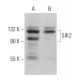 SIK2 Antibody (B-12) - Western Blotting - Image 364686