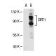 SIRT1 (B-7): sc-74465. Western blot analysis of SIRT1 expression in...