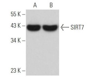 SIRT7 Antibody (C-3) - Western Blotting - Image 362138The Double Nickase Plasmid features a U6 promoter for sgRNA expression, a 20 nt targeting sequence, and a gRNA scaffold to guide Cas9n. It includes a CBh promoter for Cas9n (D10A) and puromycin resistance, GFP for transfection verification, and nuclear localization signals (NLS). The 2A peptide allows co-expression of Cas9n and Puro from a single promoter, enabling precise genome editing with reduced off-target effects.