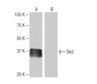 Six2 Antibody (NB-A37) - Western Blotting - Image 65051