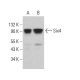 Six4 Antibody (D-5) - Western Blotting - Image 381382 