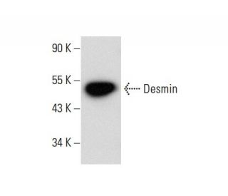 SJRH30 Cell Lysate: sc-2287. Western blot analysis of Desmin expression...