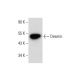 SJRH30 Cell Lysate: sc-2287. Western blot analysis of Desmin expression...