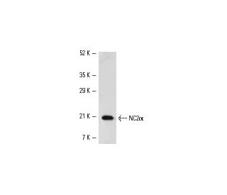 SK-BR-3 nuclear extract: sc-2134. Western blot analysis of NC2 alpha expression... 