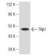 SK-BR-3 nuclear extract: sc-2134. Western blot analysis of TR beta 1 expression...