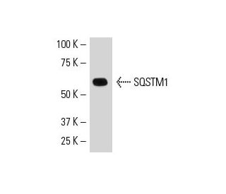 SK-LMS-1 Cell Lysate: sc-3813. Western blot analysis of SQSTM1 expression... 